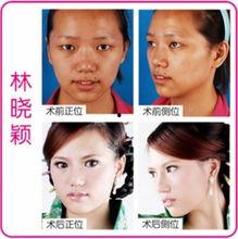 微整形隆鼻最新爆料视频,网红爆料视频大揭秘